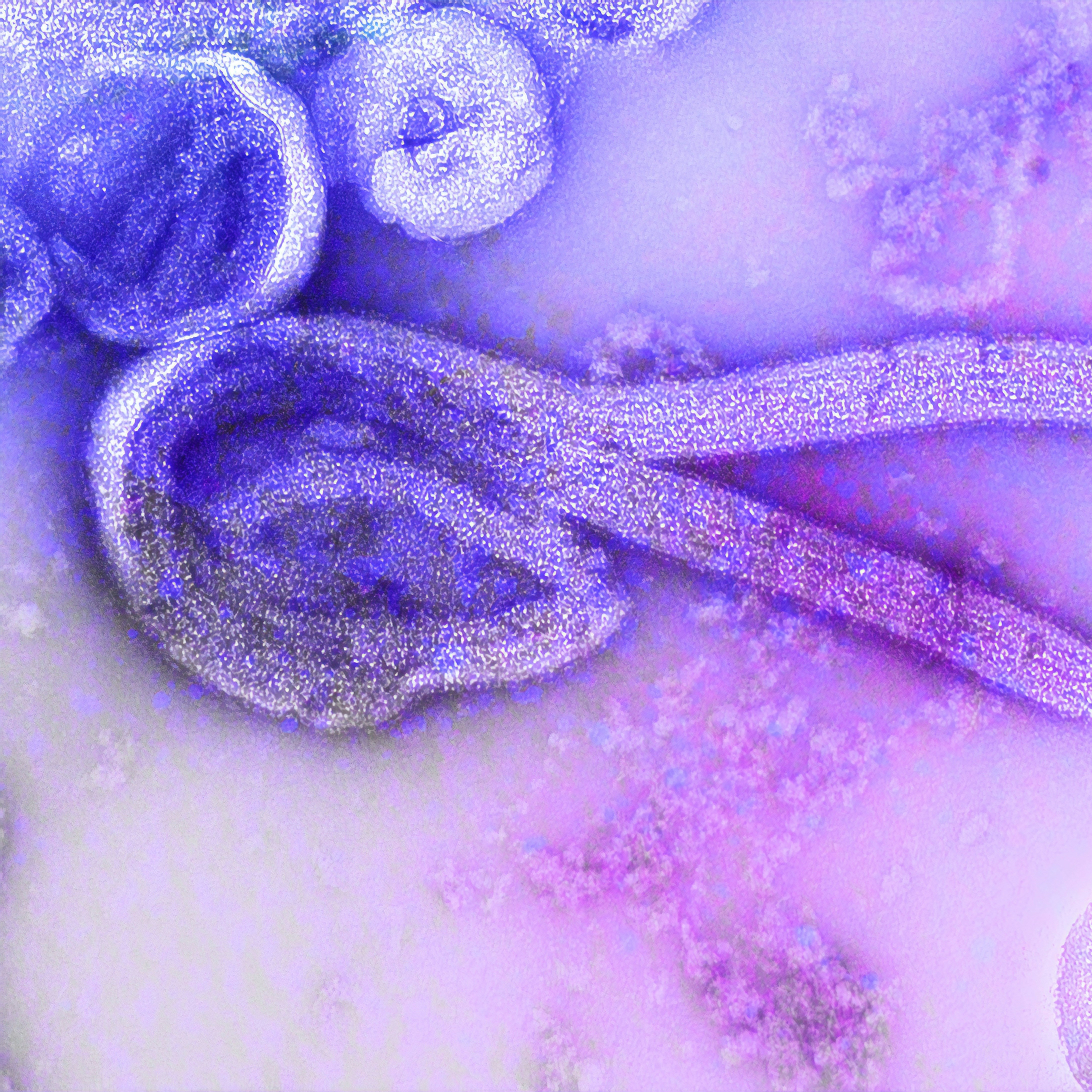 Unsplash image for Ebola