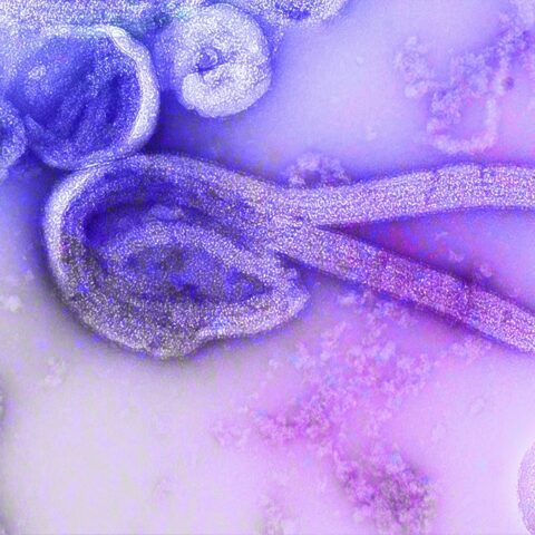 Unsplash image of Ebola