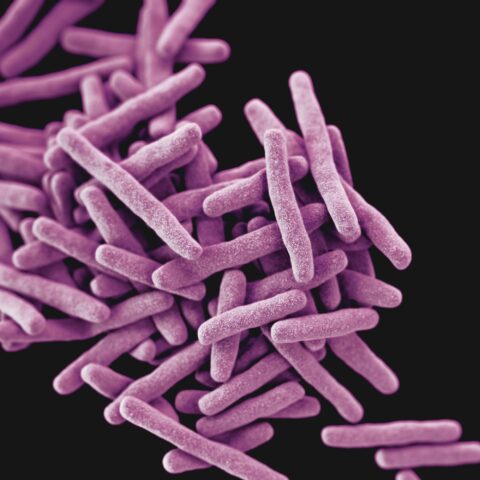 Unsplash image of tuberculosis bacteria